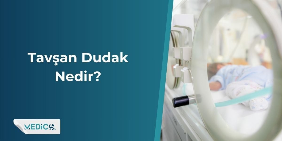 Tavşan Dudak Nedir?