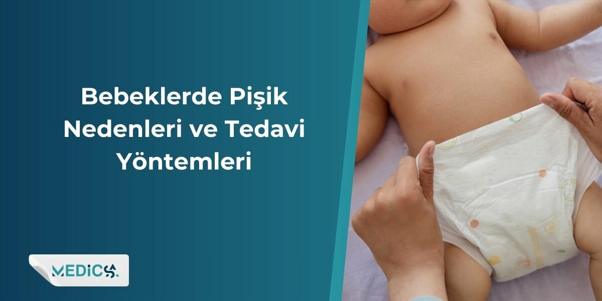 Bebeklerde Pişik Nedenleri ve Tedavi Yöntemleri